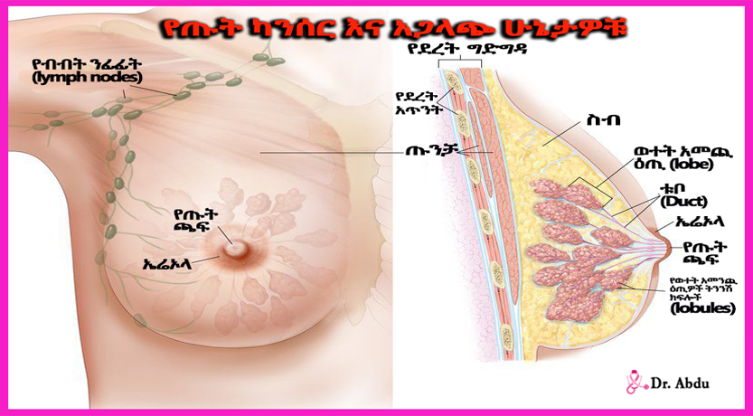 Read more about the article የጡት ካንሰር እና አጋላጭ ሁኔታዎቹ