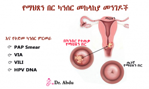 Read more about the article የማህጸን በር ካንሰር መከላከያ መንገዶች